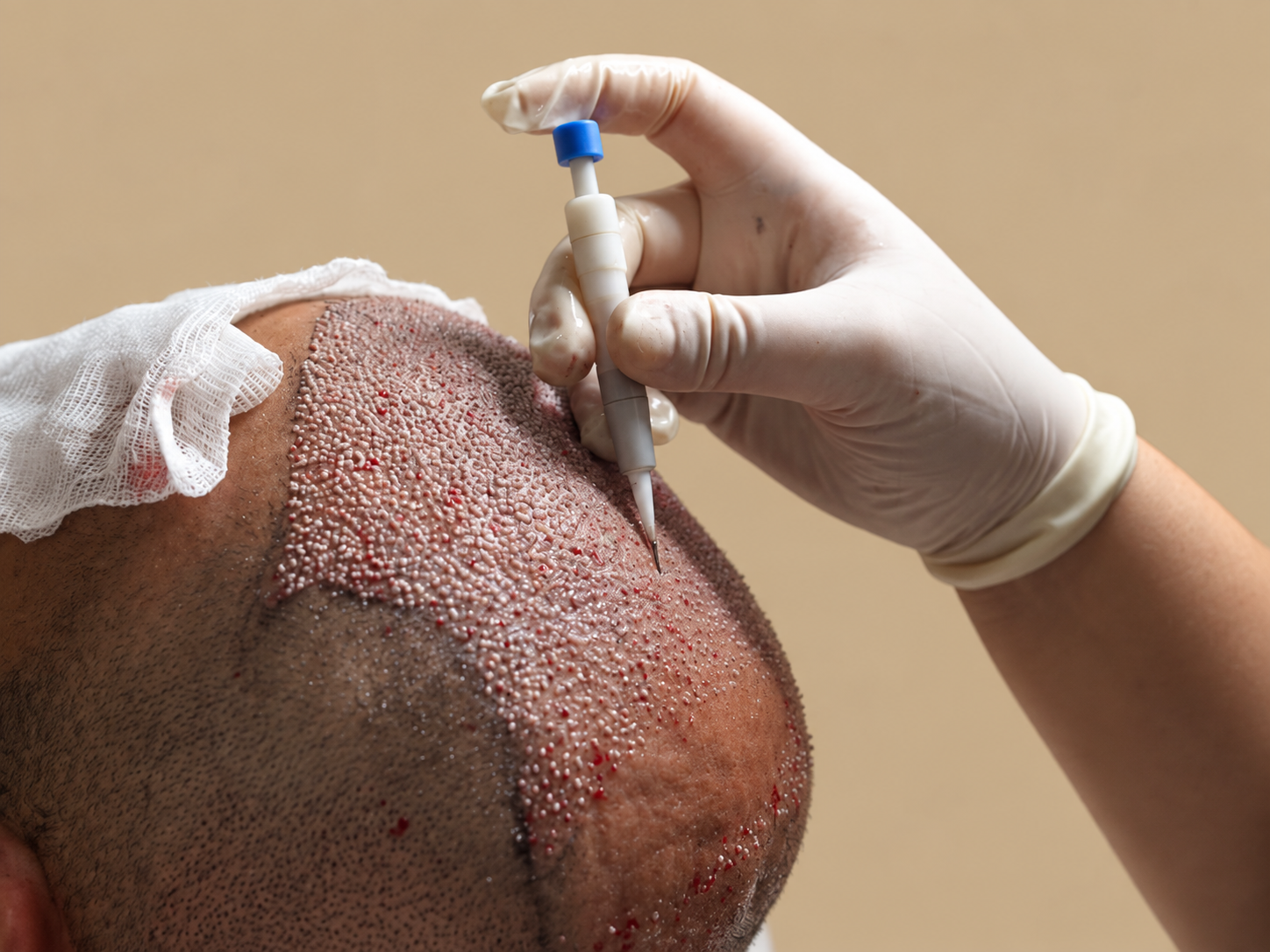 Clinical treatment setting