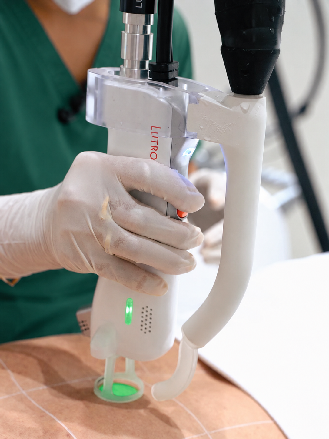 Clarity II laser hair removal machine